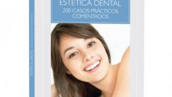 ESTETICA DENTAL 200 CASOS PRACTICOS COMENTADOS