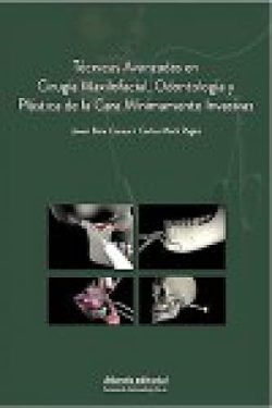 TECNICAS AVANZADAS EN CIRUGIA MAXILOFACIAL