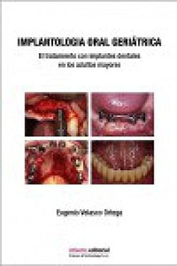 IMPLANTOLOGIA ORAL GERIATRICA EL TRATAMIENTO