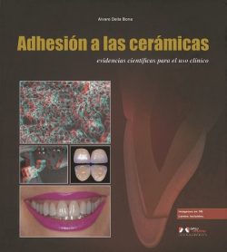 ADHESIÓN A LAS CERÁMICAS - 1RA. EDICIÓN 2009