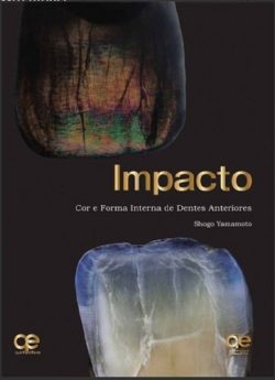 IMPACTO COR E FORMA INTERNA DE  DENTES ANTERIORES