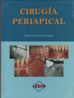CIRUGIA PERIAPICAL