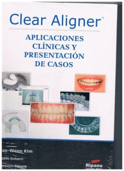 CLEAR ALIGNER APLICACIONES CLINICAS