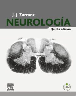 NEUROLOGIA