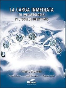 LA CARGA INMEDIATA EN IMPLANTOLOGIA