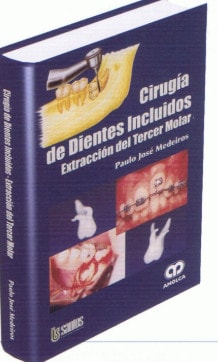 CIRUGIA DE DIENTES INCLUIDOS Y EXTRACCIONES