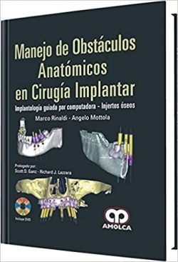 MANEJO DE OBSTACULOS ANATOMICOS EN CIRUGIA IMPLANTAR