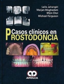 CASOS CLINICOS EN PROSTODONCIA