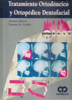 TRATAMIENTO ORTODONTICO Y ORTOPEDICO