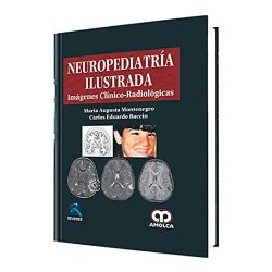 NEUROPEDIATRIA ILUSTRADA IMAGENES CLINICO RADIOLOGICAS