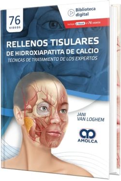 RELLENOS TISULARES DE HIDROXIAPATITA DE CALCIO