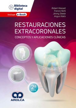 RESTAURACIONES EXTRACORONALES
