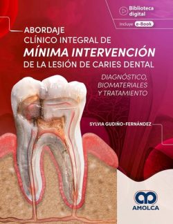 ABORDAJE INTEGRAL DE MINIMA INTERVENCION DE LA CARIES