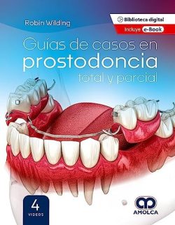 GUIAS DE CASOS EN PROSTODONCIA TOTAL Y PARCIAL