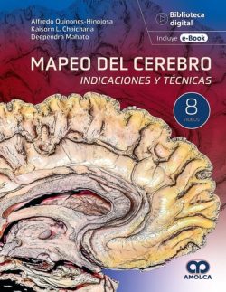 MAPEO DEL CEREBRO