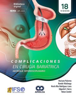 COMPLICACIONES EN CIRUGIA BARIATRICA - ABORDAJE INTERDISCIPLINARIO