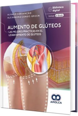 AUMENTO DE GLUTEOS