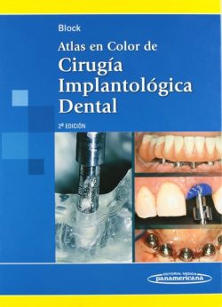 ATLAS EN COLOR DE CIRUGIA IMPLANTOLOGICA DENTAL