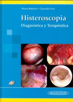 HISTEROSCOPIA DIAGNOSTICO Y TERAPEUTICA