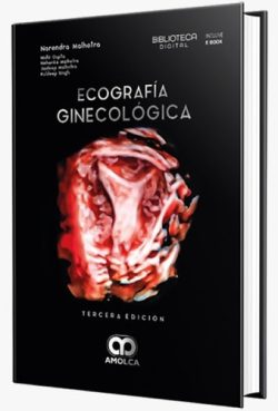 ECOGRAFIA GINECOLOGICA