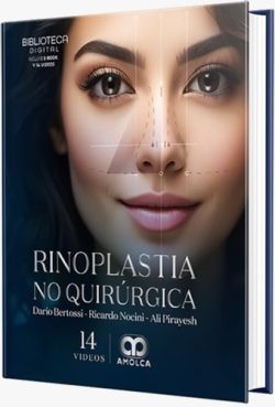 RINOPLASTIA NO QUIRURGICA