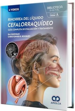 RINORREA DEL LIQUIDO CEFALORRAQUIDEO