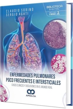 ENFERMEDADES PULMONARES POCO FRECUENTES E INTERSTICIALES