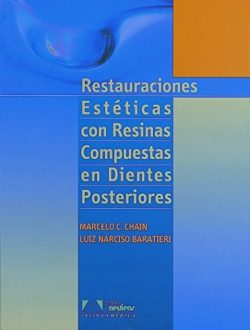 RESTAURACIONES ESTETICAS CON RESINAS COMPUESTAS