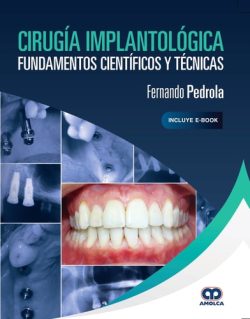 CIRUGIA IMPLANTOLOGICA - FUNDAMENTOS CIENTIFICOS