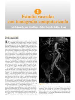 ACTUALIZACIONES EN SERAM RADIOLOGIA VASCULAR NO INVASIVA
