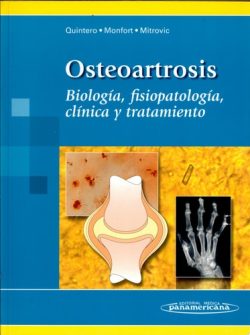 OSTEOARTROSIS BIOLOGIA FISIOPATOLOGIA CLINICA Y TRATAMIENTO