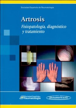 ARTROSIS FISIOPATOLOGIA DIAGNOSTICO Y TRATAMIENTO