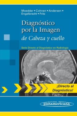 DIAGNOSTICO POR IMAGEN DE CABEZA Y CUELLO