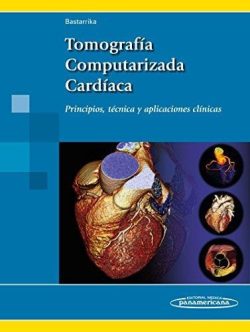TOMOGRAFIA COMPUTARIZADA CARDIACA
