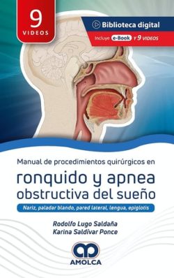 MANUAL DE PROCEDIMIENTOS QUIRURGICOS EN RONQUIDOS Y APNEA