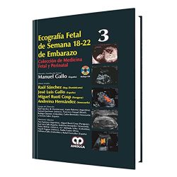 ECOGRAFIA FETAL DE SEMANA 18-22 DE EMBARAZO