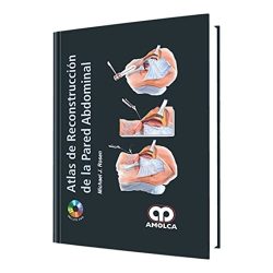 ATLAS DE RECONSTRUCCION DE LA PARED ABDOMINAL
