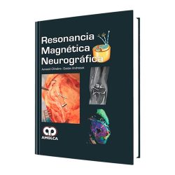RESONANCIA MAGNETICA NEUROGRAFICA
