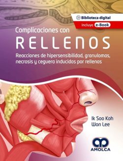 COMPLICACIONES CON RELLENOS