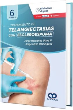 TRATAMIENTO DE TELANGIECTASIAS