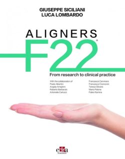 ALIGNERS F22