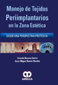 MANEJO DE TEJIDOS PERIIMPLANTARIOS EN LA ZONA ESTETICA