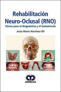 REHABILITACION NEURO OCLUSAL  (RNO)  1ERA EDICION
