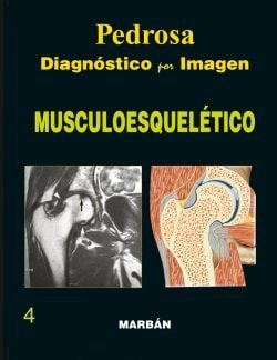 DIAGNOSTICO POR IMAGEN MUSCULOESQUELETICO