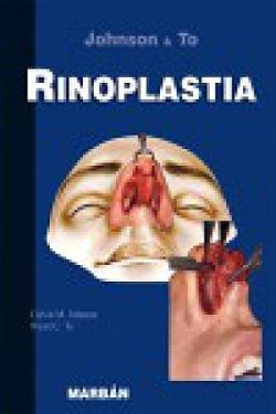 RINOPLASTIA