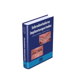 SOBREDENTADURA IMPLANTOSOPORTADA