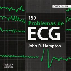 150 PROBLEMAS DEL ECG