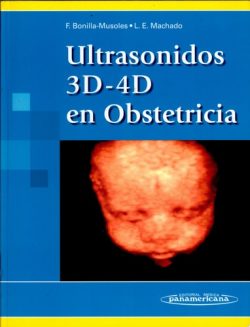 ULTRASONIDOS 3D-4D EN OBSTETRICIA