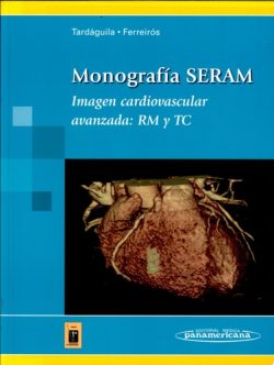 MONOGRAFIA SERAM IMAGEN CARDIOVASCULAR AVANZADA RM Y TC