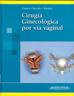 CIRUGIA GINECOLOGICA POR VIA VAGINAL